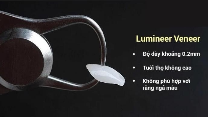 Có bao nhiêu loại mặt dán sứ? Loại nào là tốt nhất và phổ biến nhất hiện nay?